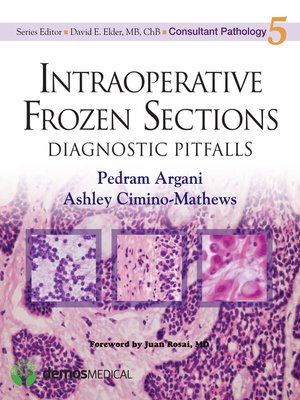 cover image of Intraoperative Frozen Sections